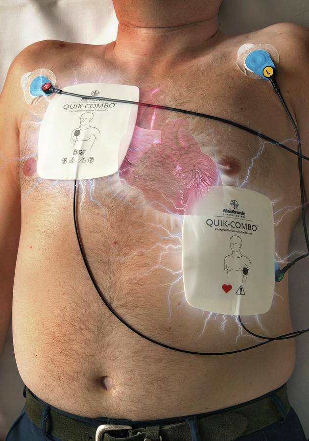 heart-attack-patient-photograph-by-doncaster-and-bassetlaw-hospitals