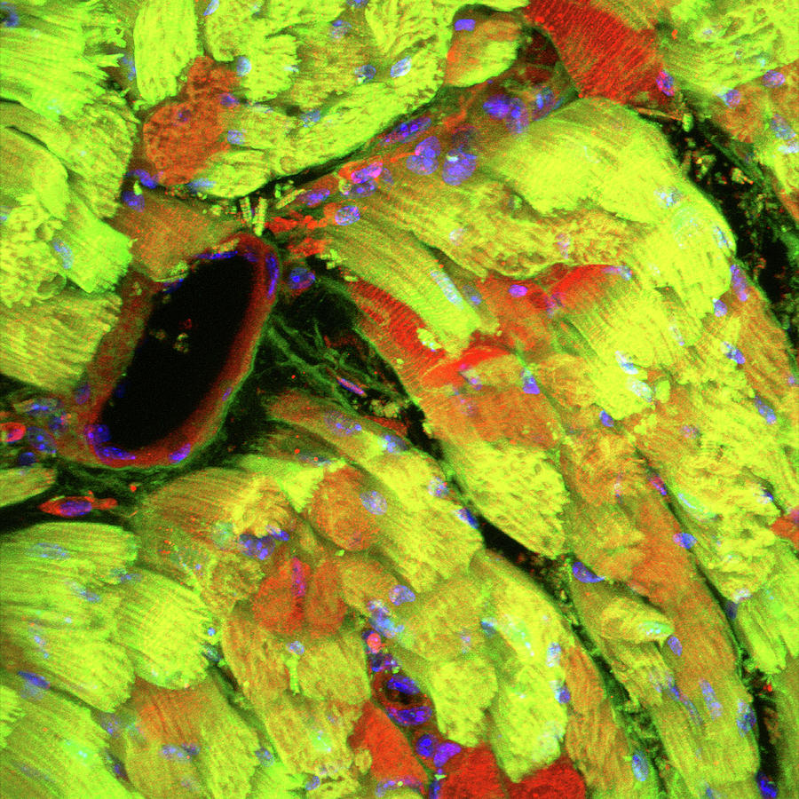Heart Muscle #1 Photograph by C.j.guerin, Phd, Mrc Toxicology Unit/ Science Photo Library