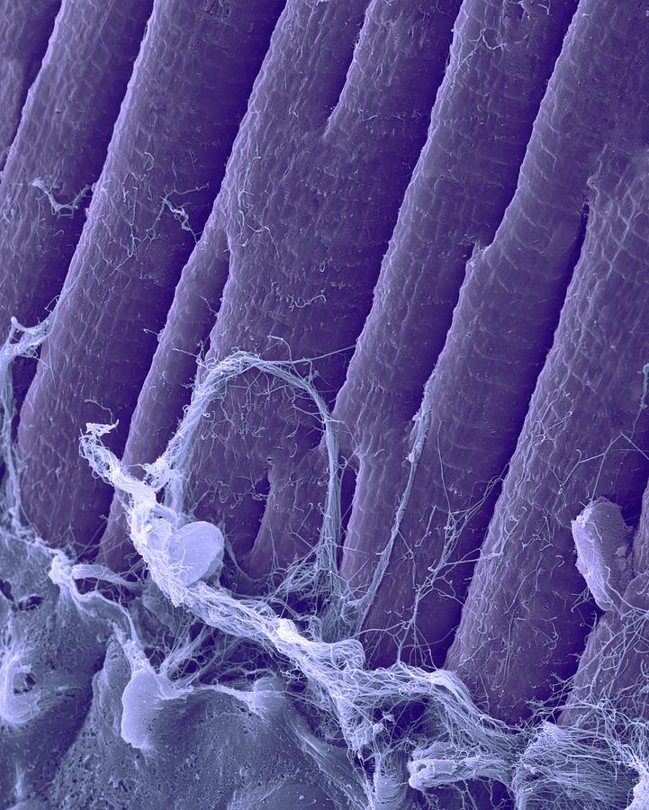 Heart Muscle Fibres  #1 Photograph by Dennis Kunkel Microscopy/science Photo Library