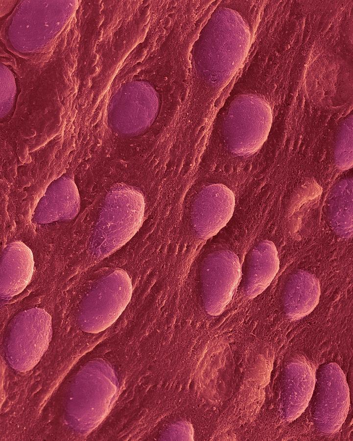 Heart Pericardium Surface #1 Photograph by Dennis Kunkel Microscopy/science Photo Library