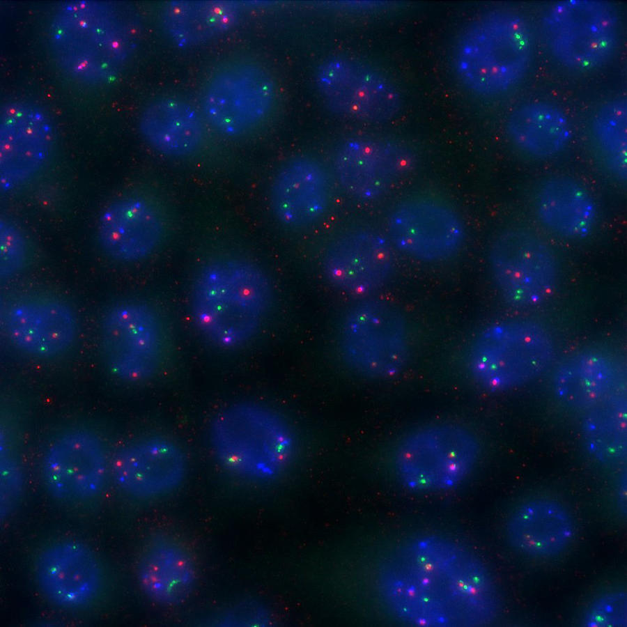 Hela Cells, Hipmap #1 Photograph by Science Source