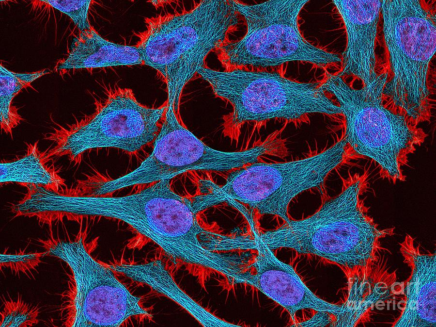 Microtubule Photograph - Hela Cells, Light Micrograph #1 by National Institutes Of Health