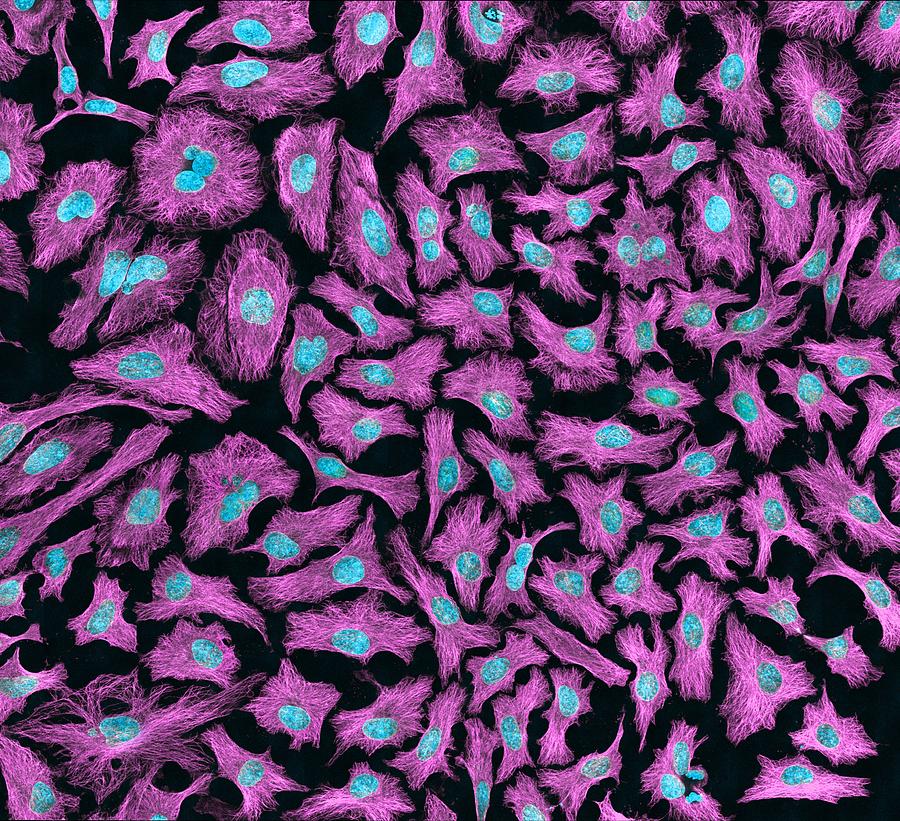 HeLa cells, light micrograph #1 Photograph by Science Photo Library
