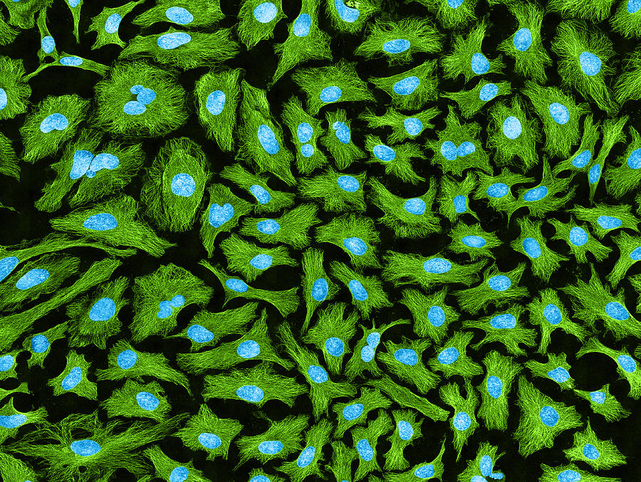 Hela Cells, Mfm #1 Photograph by Science Source