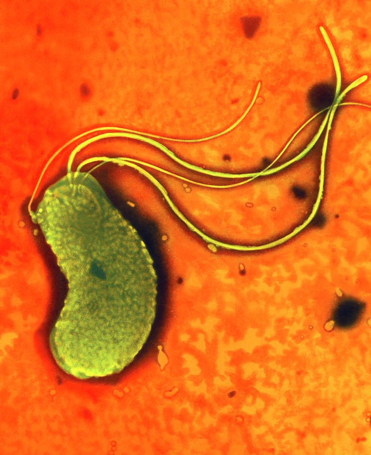 Helicobacter Pylori Photograph - Helicobacter Pylori Bacterium #1 by A. Dowsett, Health Protection Agency/science Photo Library