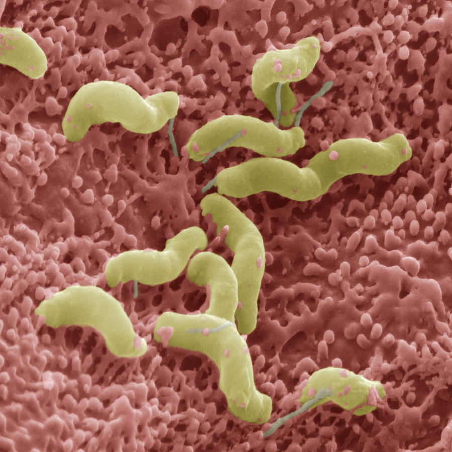 Helicobacter Pylori #1 Photograph by Eye of Science