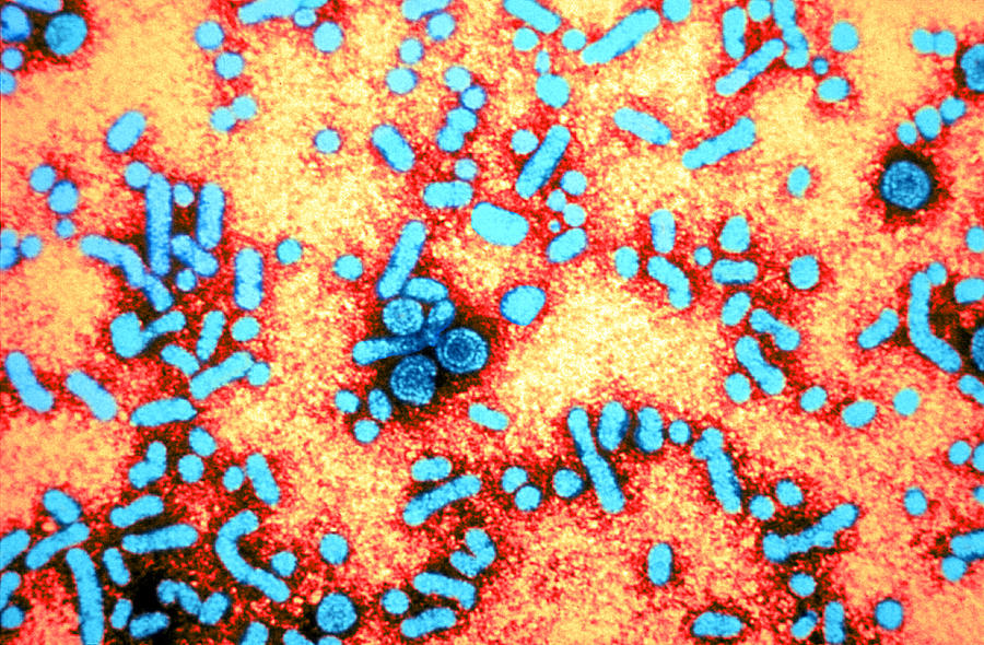 Hepatitis-b Virus, Tem #1 Photograph by Science Source