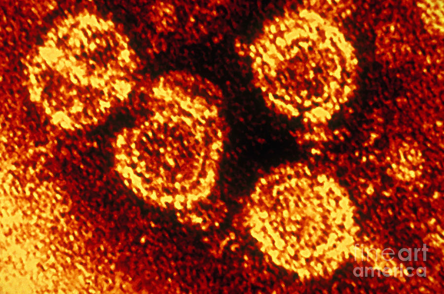 Hepatitis B Virus Tem #1 Photograph by Scott Camazine