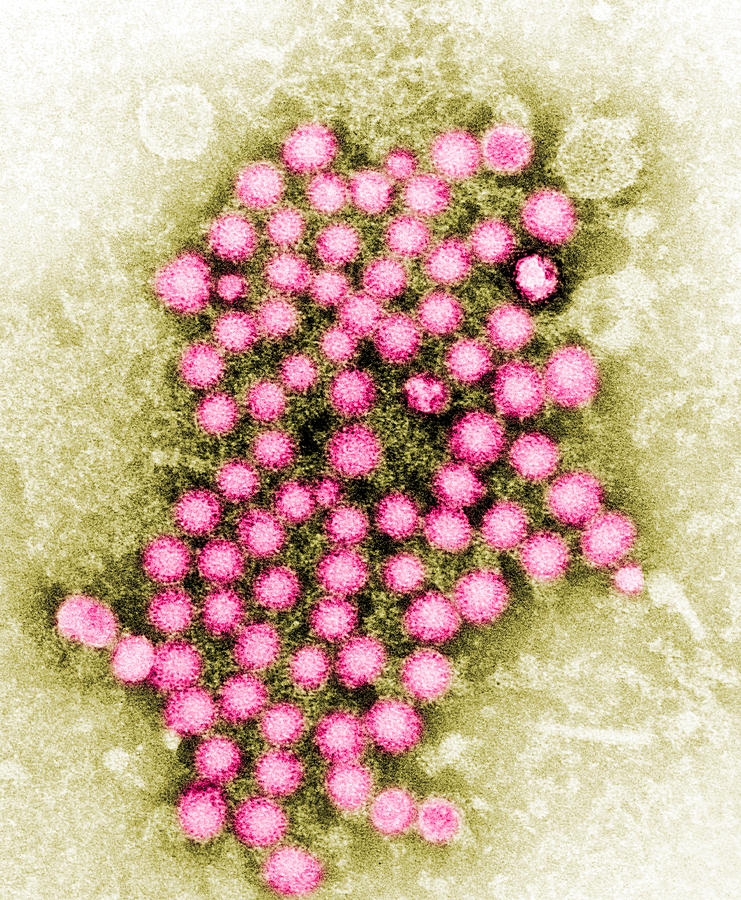 Science Photograph - Hepatitis Virus TEM by Science Source