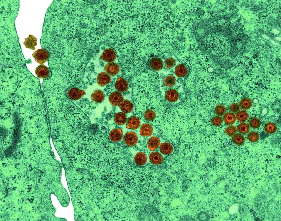 Herpes Simplex Virus #1 Photograph by Dennis Kunkel Microscopy/science Photo Library