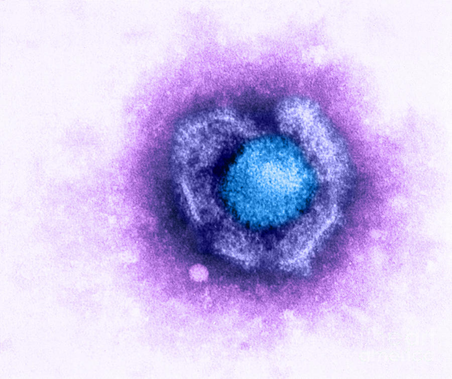 Herpes Simplex Virus #1 Photograph by Kwangshin Kim