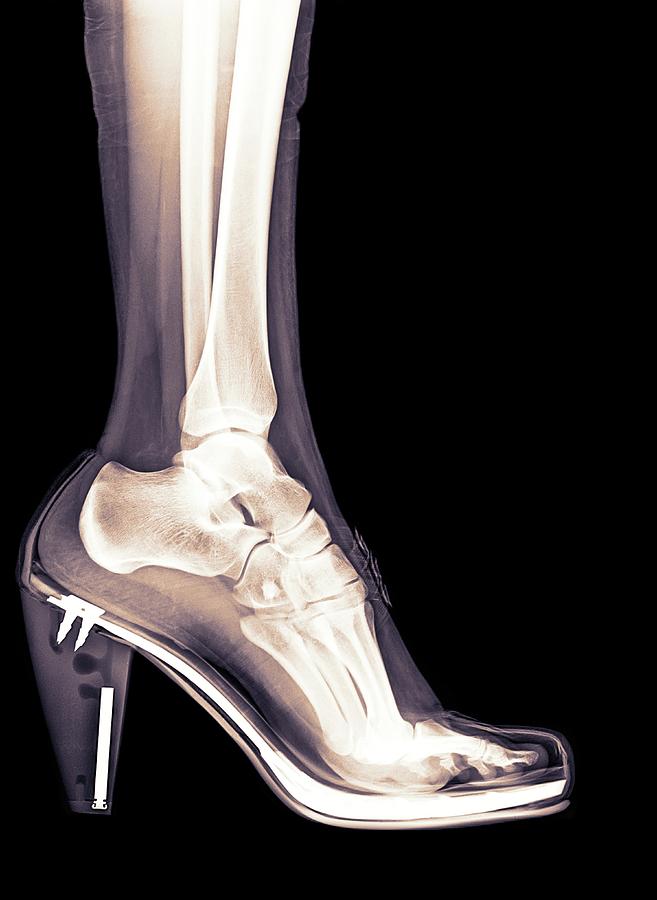 High Heel Shoe X-ray Photograph by Photostock-israel