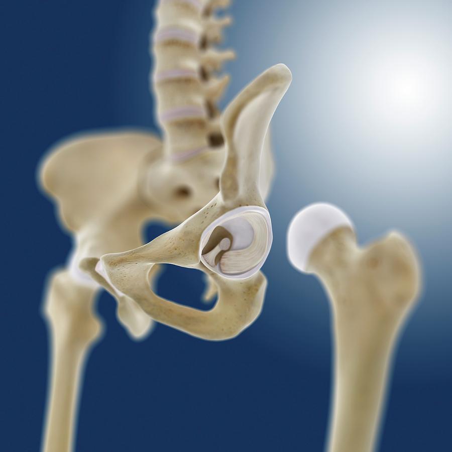 Hip Socket Anatomy Photograph By Springer Medizin