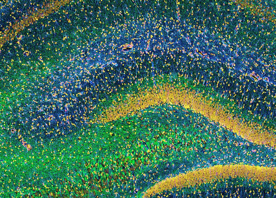 Hippocampus Brain Tissue #1 Photograph by Thomas Deerinck, Ncmir