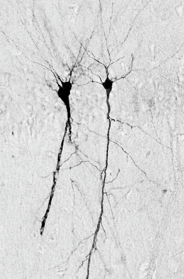 Hippocampus Pyramidal Neurons #1 Photograph by Dennis Kunkel Microscopy/science Photo Library