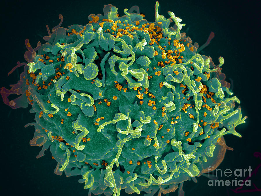 Hiv, T Cell Under Attack, Sem #1 Photograph by Science Source