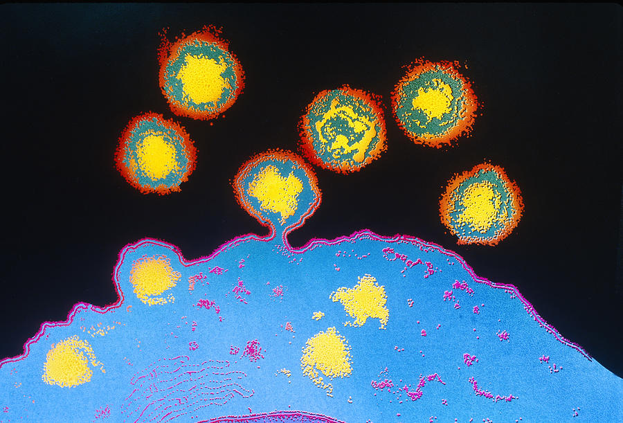 Hiv Virus Budding From T4 Lymphocyte #1 Photograph by Chris Bjornberg