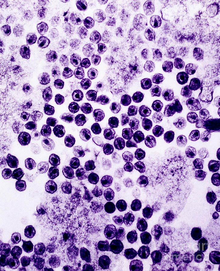 Hiv Virus #1 Photograph by David M. Phillips