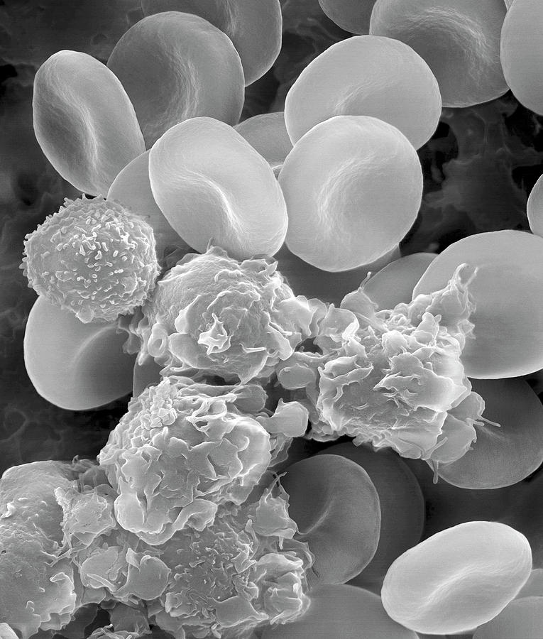 Human Blood Cells And Activated Platelets #1 Photograph by Dennis Kunkel Microscopy/science Photo Library