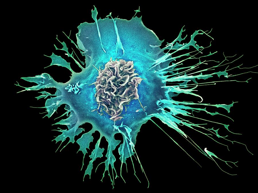 Human Dendritic Cell 1 Photograph By Dennis Kunkel Microscopy Science   1 Human Dendritic Cell Dennis Kunkel Microscopyscience Photo Library 