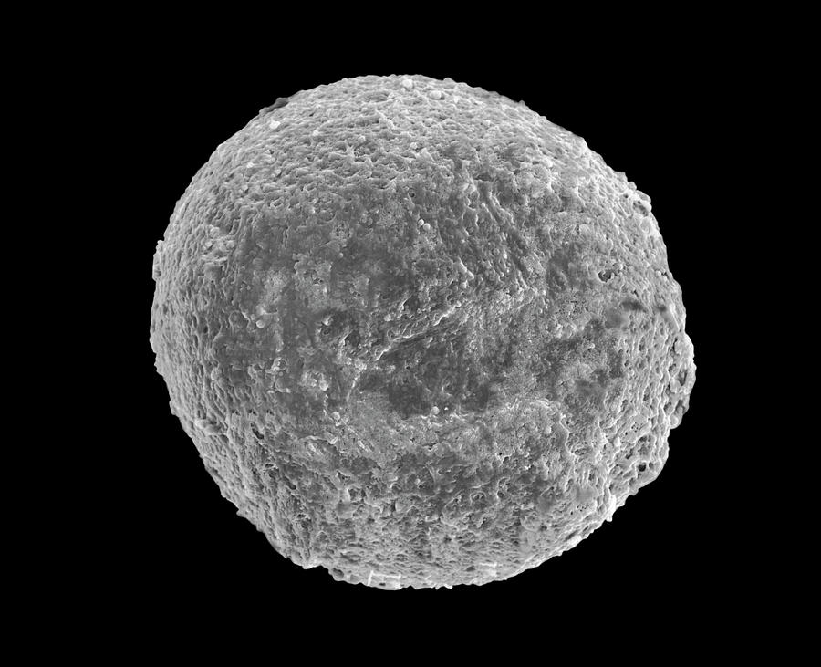 Human Egg #1 Photograph by Dennis Kunkel Microscopy/science Photo ...