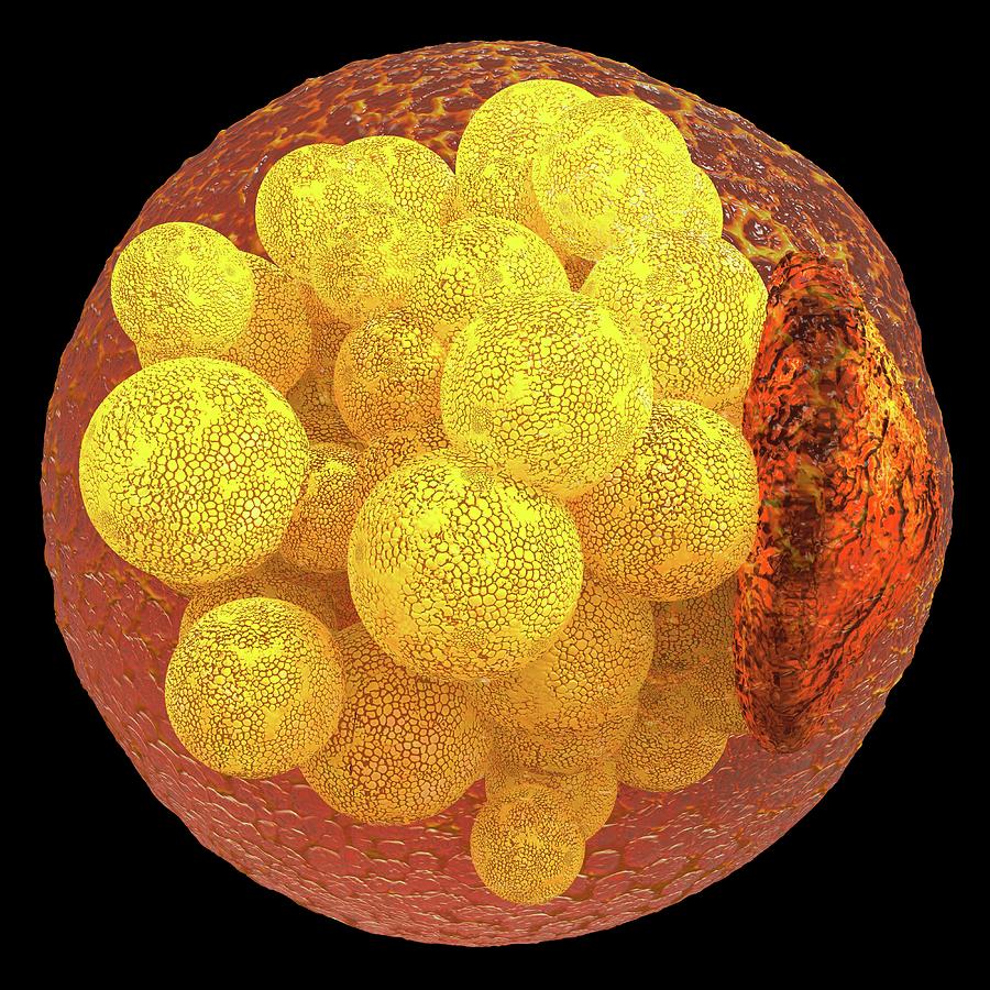Human Fat Cell #1 Photograph by Alfred Pasieka/science Photo Library