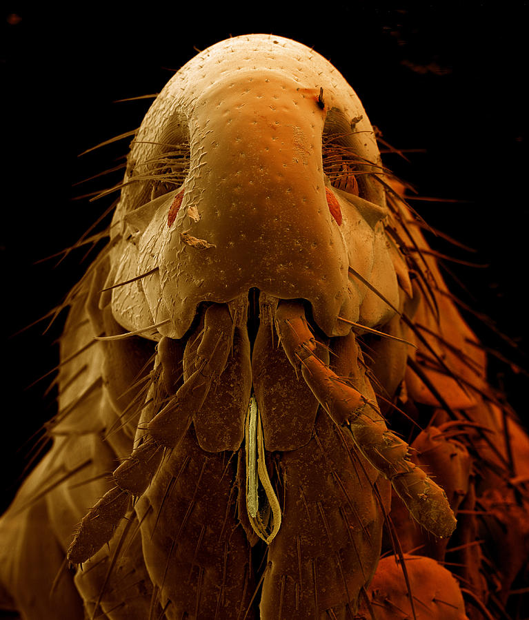 Human Flea #2 Photograph by Eye of Science