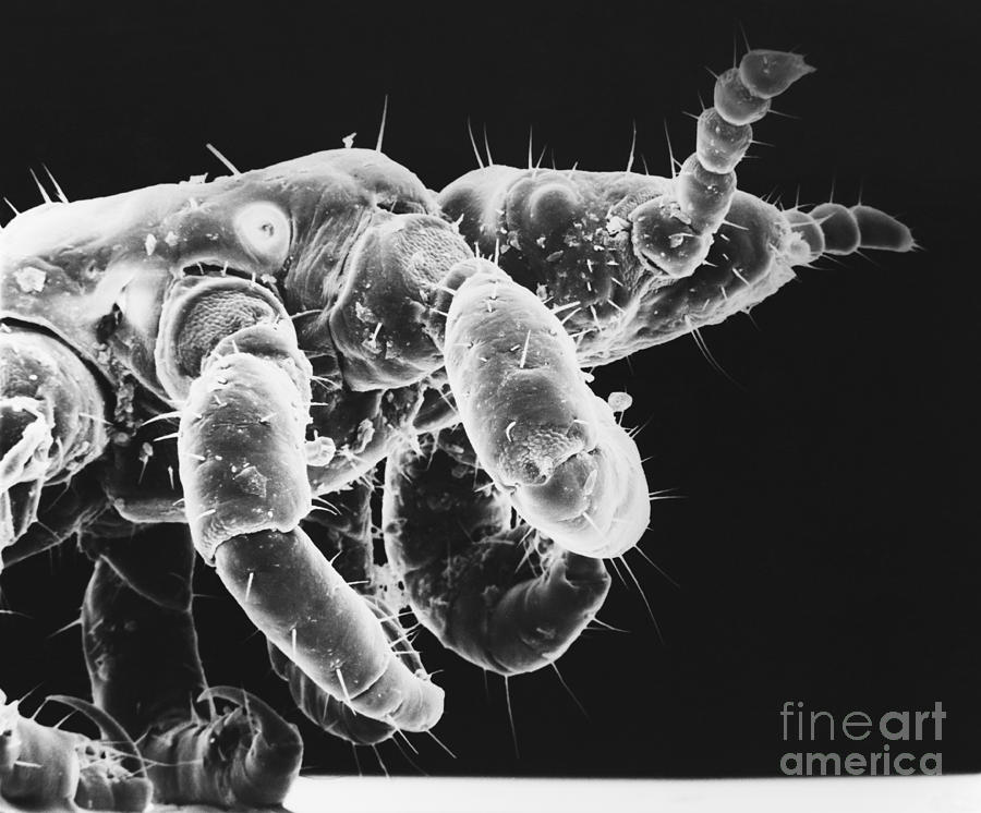 Human Head Louse #1 Photograph by David M. Phillips