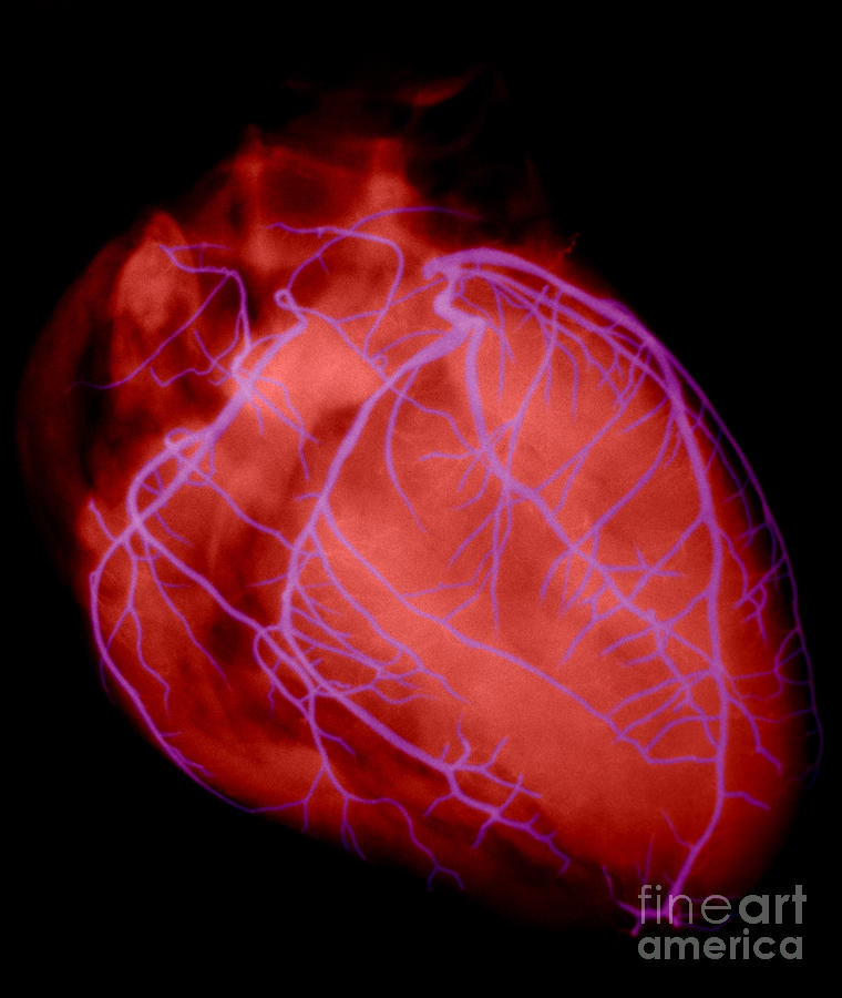 Human Heart #1 Photograph by David Bassett