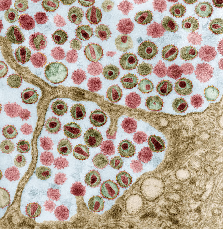Human Immunodeficiency Virus, Tem #1 Photograph by Eye of Science