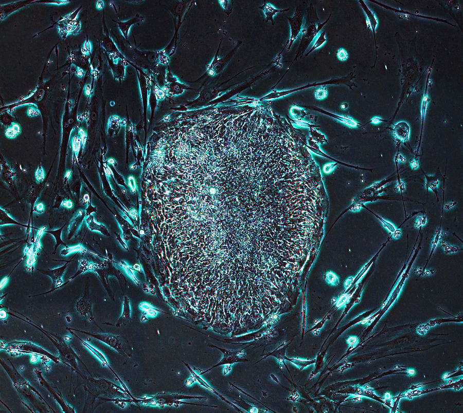 Human Induced Pluripotent Stem Cells, Lm #1 Photograph by Science Source