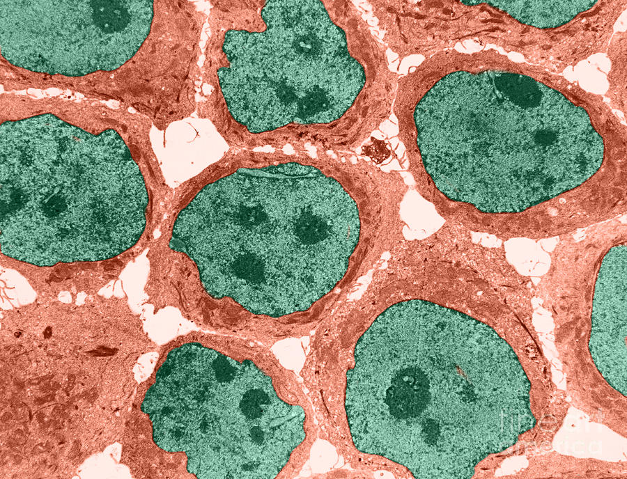 Human Kb Cells Tem #1 Photograph by David M. Phillips