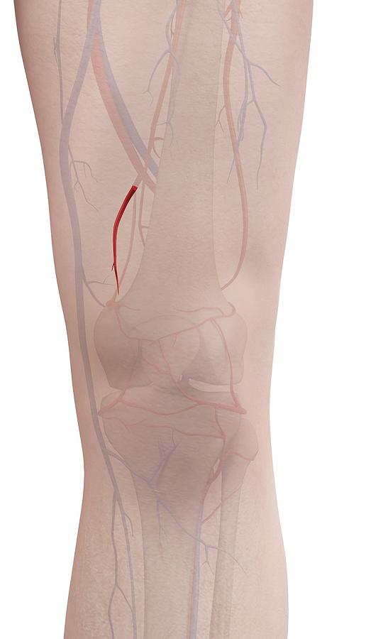 Human Leg Artery Photograph By Sciepro Fine Art America 2475