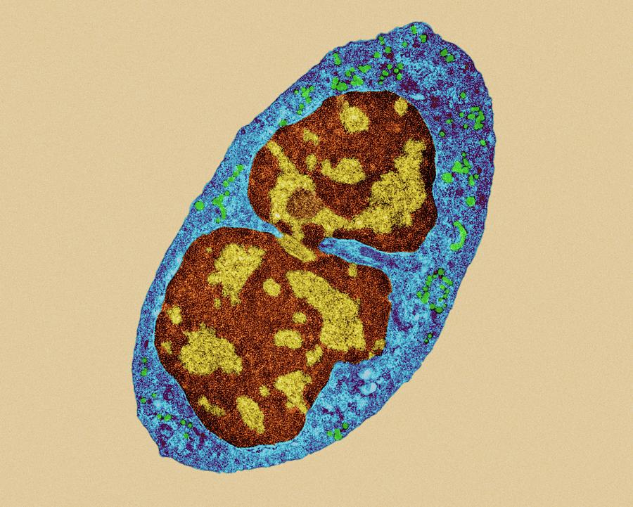Human Neutrophil Photograph by Dennis Kunkel Microscopy/science Photo ...