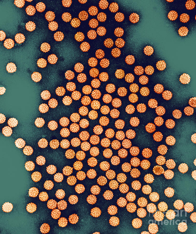 Human Papilloma Virus #3 Photograph by Kwangshin Kim