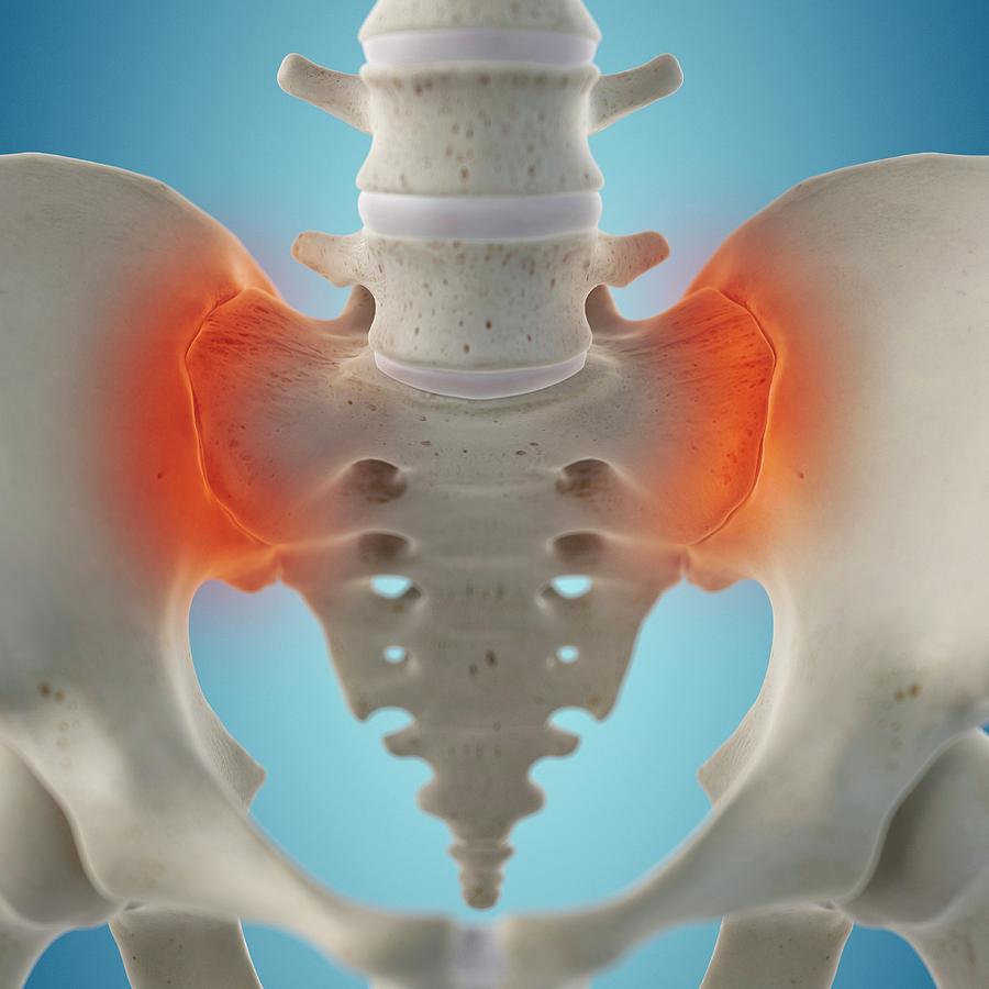 Human Sacroiliac Joint Photograph by Sciepro - Pixels