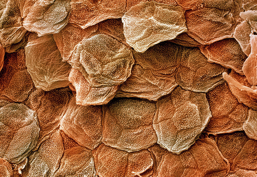 Human Skin Sem #1 Photograph by Power And Syred