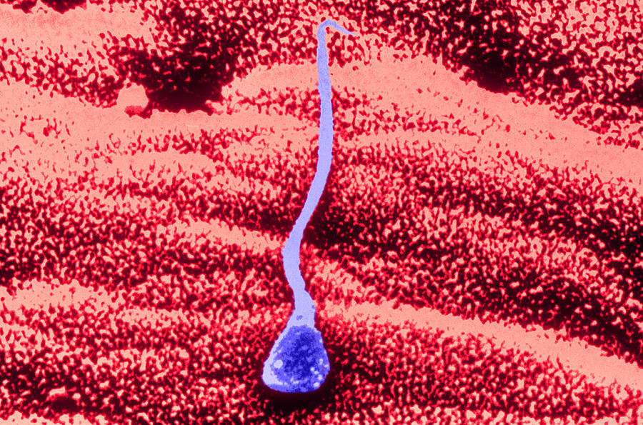 Human Sperm In Uterus #1 Photograph by John Watney