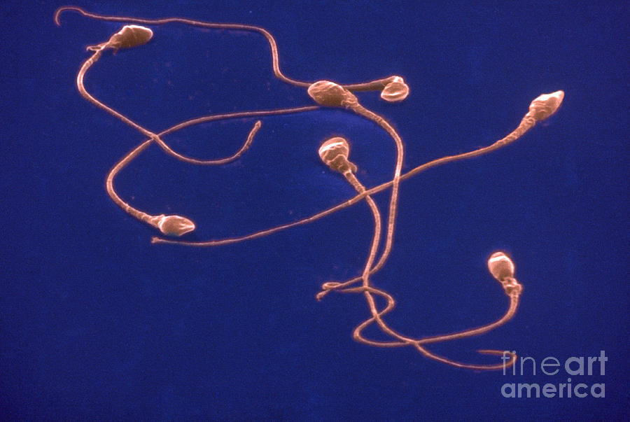 Human Sperm, Sem #1 Photograph by David M. Phillips