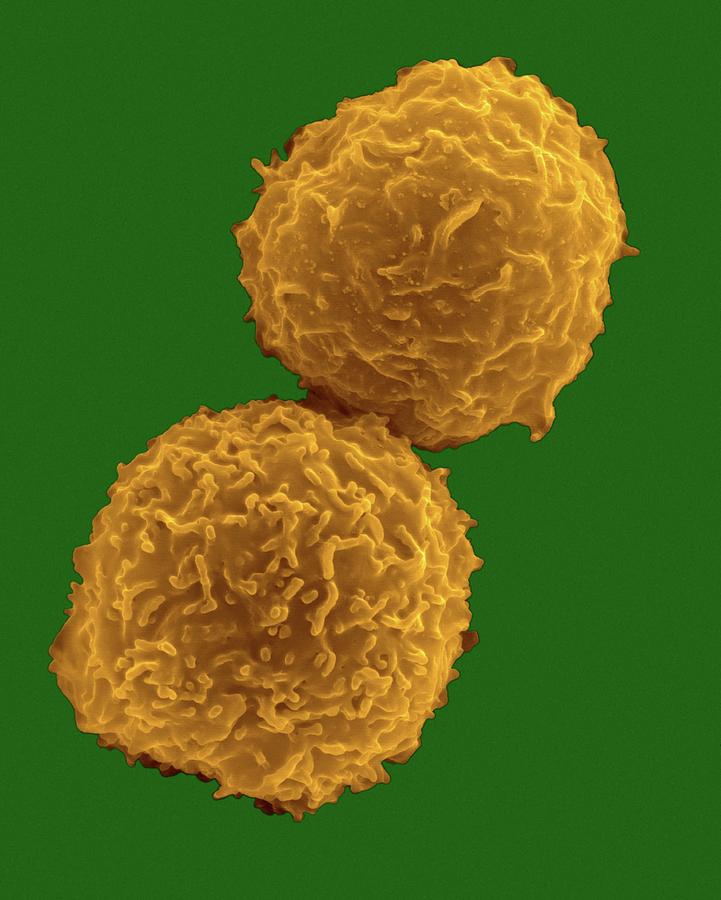 Human Body Photograph - Human Stem Cells From Bone Marrow #1 by Dennis Kunkel Microscopy/science Photo Library