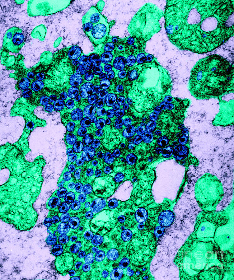 Tem Photograph - Human T-lymphocyte Showing Hiv #1 by Kwangshin Kim