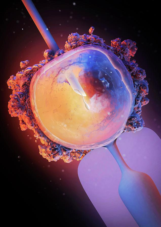 Icsi In Vitro Fertilisation Photograph By Maurizio De Angelisscience Photo Library Fine Art 