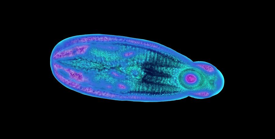 Immature Fluke Photograph by Steve Gschmeissner/science Photo Library ...