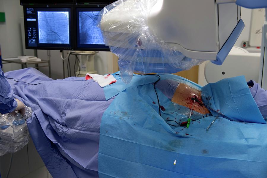 Implantable Defibrillator Surgery Photograph by Dr P. Marazzi/science ...