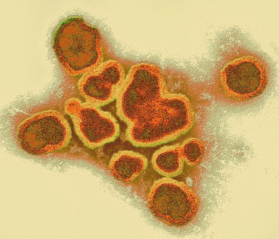 Influenza A Virus Particles #1 Photograph by Ami Images/science Photo Library