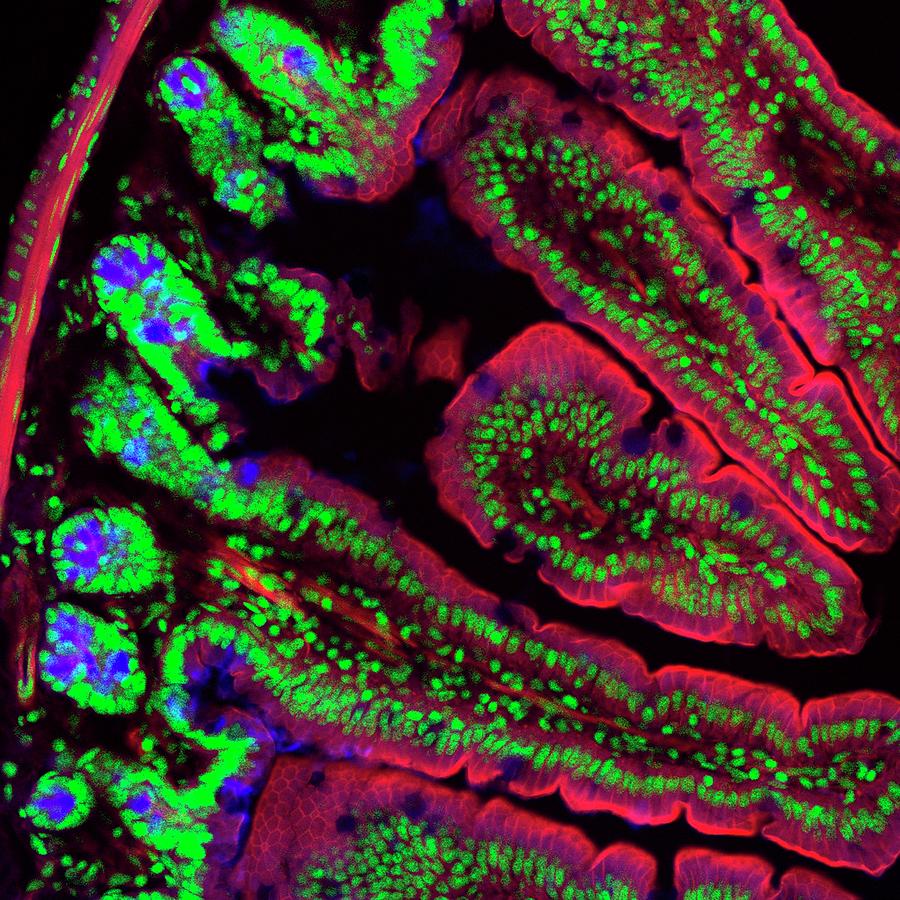 Intestinal Tissue Photograph by Kevin Mackenzie / University Of ...