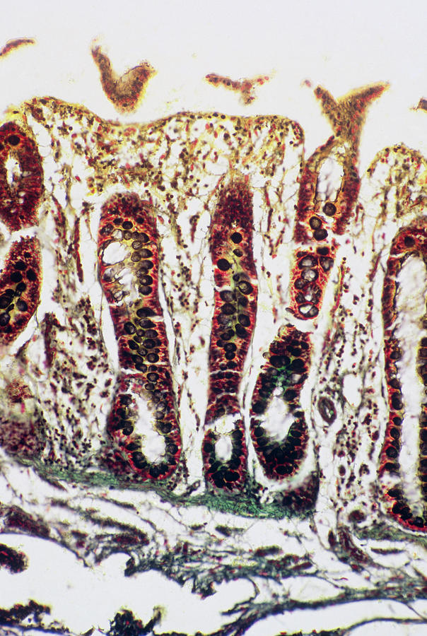 Intestinal Villi #1 Photograph by Astrid & Hanns-frieder Michler/science Photo Library