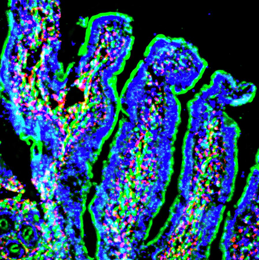 Intestinal Villi #1 Photograph by R. Bick, B. Poindexter, Ut Medical School/science Photo Library