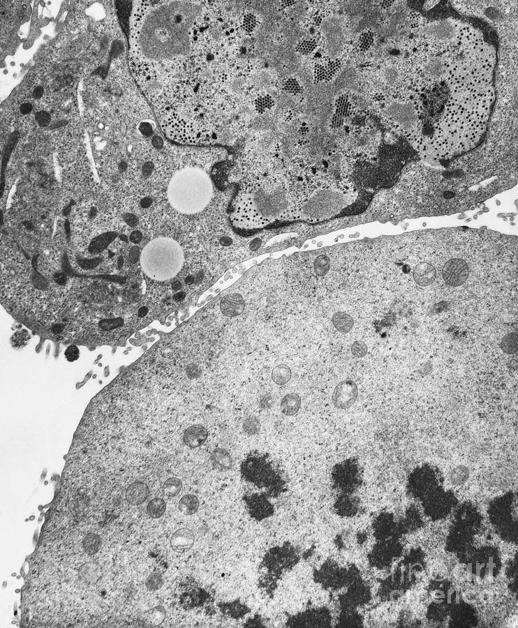 Kb Cell Infected With Adenovirus Tem #1 Photograph by David M. Phillips