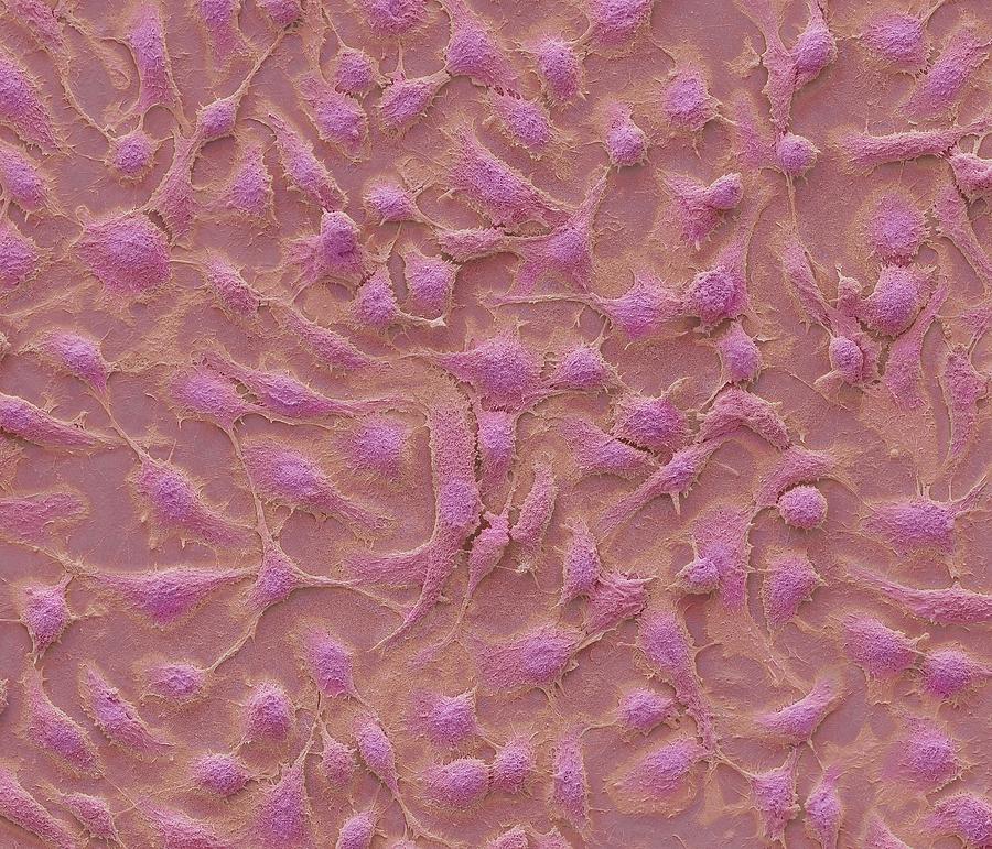 Biological Photograph - Keratinocytes #1 by Steve Gschmeissner